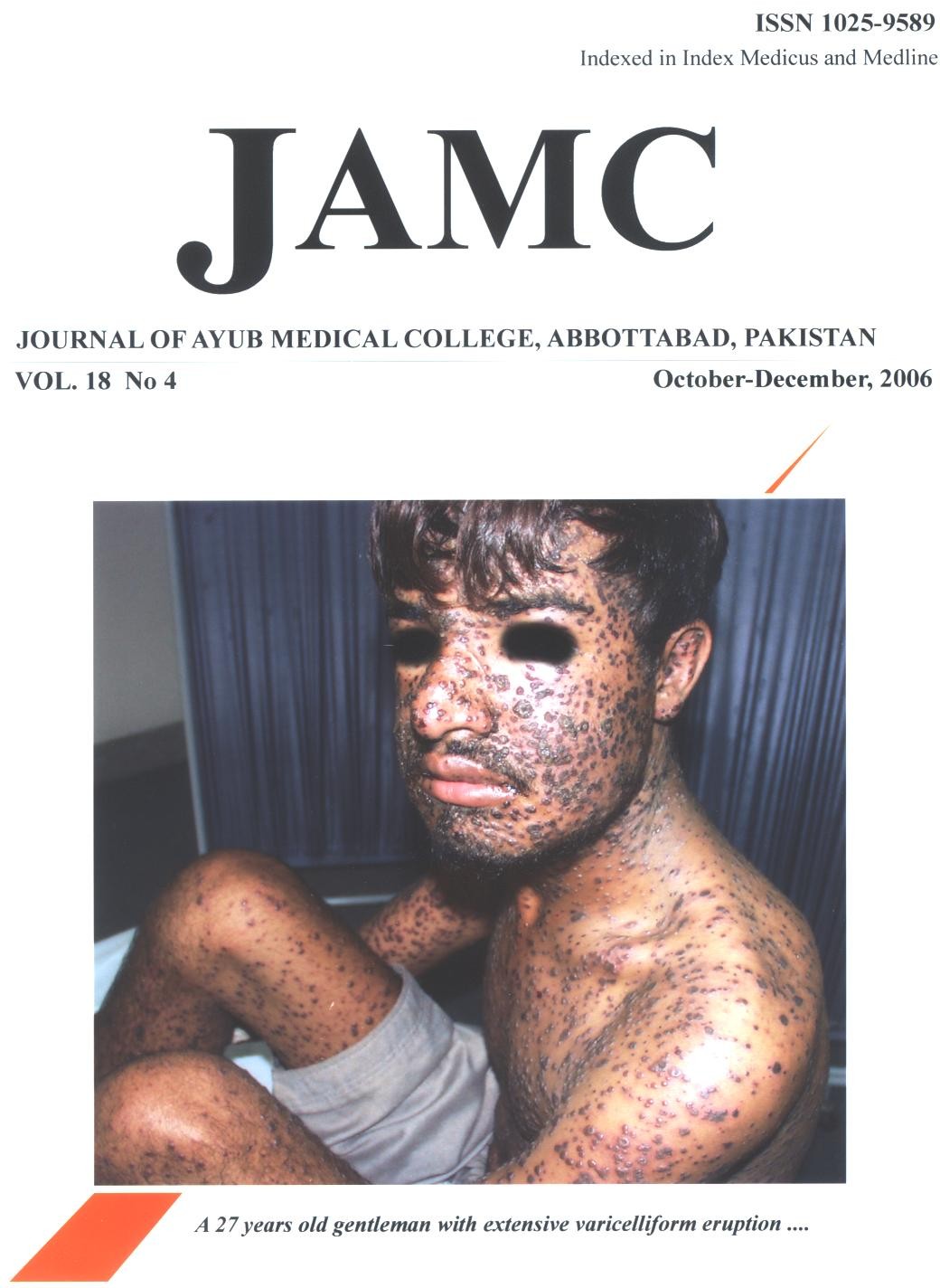 					View Vol. 18 No. 4 (2006): JOURNAL OF AYUB MEDICAL COLLEGE, ABBOTTABAD
				